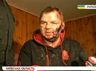 Dmytro Bulatov novinám ukázal svá zranní (31. ledna 2014)