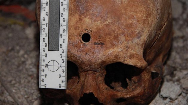 Druhá ze dvou lebek nalezených na Přerovsku ležela za dveřmi věžičky hrádku Kunzov. Spodní čelist byla položena vedle samotné lebky, v jejímž čele je kruhový otvor.