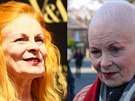 Vivienne Westwoodová vymnila dlouhé zrzavé vlasy za krátký bílý sestih.
