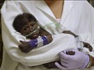 Gorilí mlád narozené v Safari parku v San Diegu má zápal plic.