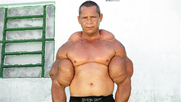 Brazilec Arlindo de Souza m nejvt bicepsy, nen to ovem dky cvien.