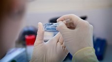 Výzkum zam��ený na lé�bu rakoviny. Ilustra�ní snímek.