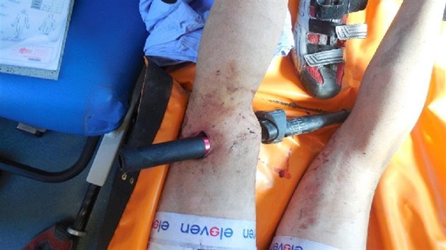 Cyklista upadl na řídítka tak nešťastně, že mu propíchla nohu. Vyndali je lékaři v příbramské nemocnici.  (7.6.2014)