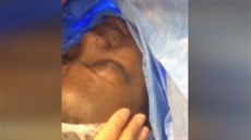 31letá guinejská zpvaka Alama Kante podstoupila operaci títné lázy v...