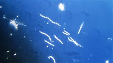 Bakterie Borrelia burgdorferi ve 400násobném zv�t�ení. Snímek je vytvo�ení tzv....