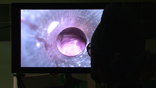 Byli jsme v děloze, sledujte 3D záběry z laparoskopické operace - iDNES.cz