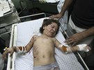 Palestinské dít zranné pi izraelských náletech na Pásmo Gazy (16. ervence...