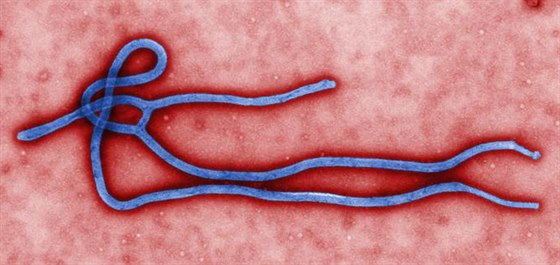 Mikroskopický pohled na virus eboly