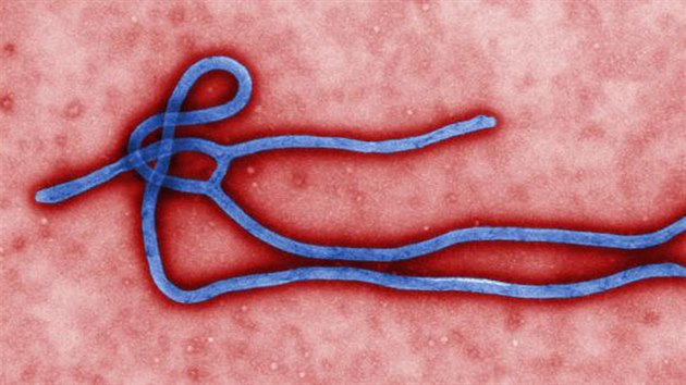 Mikroskopick pohled na virus eboly