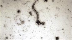Virus ebola pod mikroskopem
