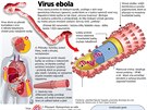 Co zpsobuje virus ebola