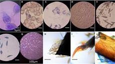 Ukázky obrázk� získaných z mikroskopu: (A) Giardia lamblia (2,180X), (B)...