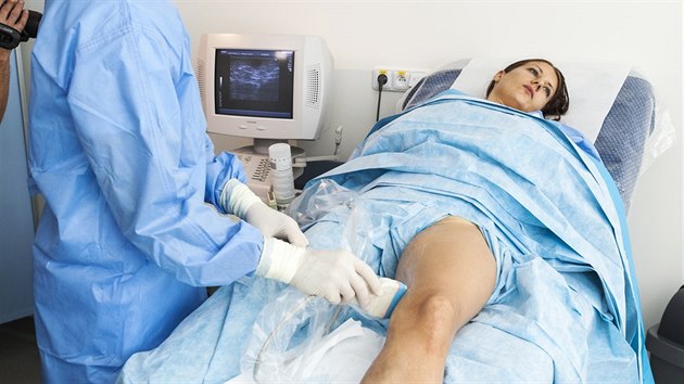 Na zatku operace najde lka pomoc ultrazvuku konec pokozen ly. Na tomto mst pak zavede kattr.
