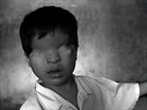 JAN IBÍK, VOLNÝ: Ústav pro slepé dti. Rangún, Barma, íjen 2013 (Kadodenní...