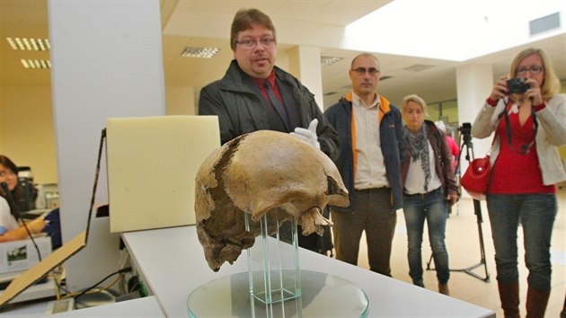 Tborsk nemocnice vytvoila pomoc potaov tomografie prostorov snmek ostatk lebky, kter mohla patit Janu ikovi z Trocnova.