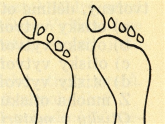 Otisk bosé nohy - ve stoji (vlevo), v chzi (vpravo).