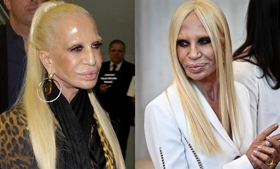 Donatella Versace to nepřehání jen s plastikami, ale i hubnutím - iDNES.cz