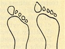 Otisk bosé nohy - ve stoji (vlevo), v chzi (vpravo).