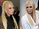 Donatella Versace si nechala vyehlit obliej (vlevo snímek z listopadu a...