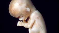 Ve trnáctém týdnu má plod zavené oi, zstanou tak a do dvacátého osmého...