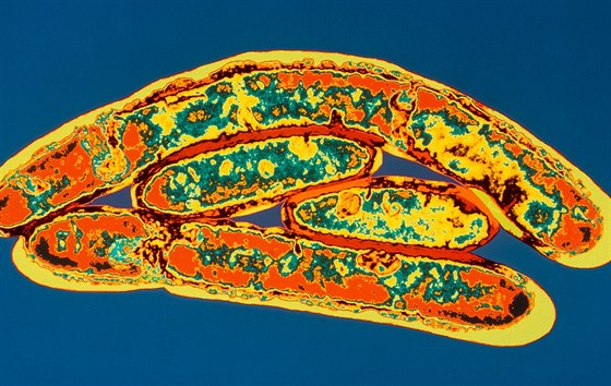 Bakterie Legionella pneumophila, která zpsobuje plicní infekci legionelóza.