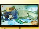 Karlovarské kardiocentrum penáelo online operaci vnitých tepen.