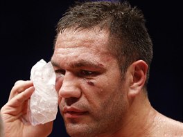 Bulharsk boxer Pulev m po KO od Vladimra Klika zlomenou lcn kost a otes...