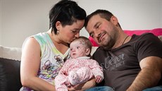 Rebeka �iháková trpí vzácnou nemocí motýlích k�ídel. Její ruce jsou plná...