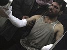 Zranný mu dostává pomoc v syrské nemocnici, podle aktivist byl zrann pi...