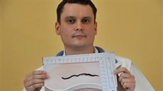 Krnovský urolog Jan Pulcer ukazuje fotografii ledvinovce psího, kterého mla v...