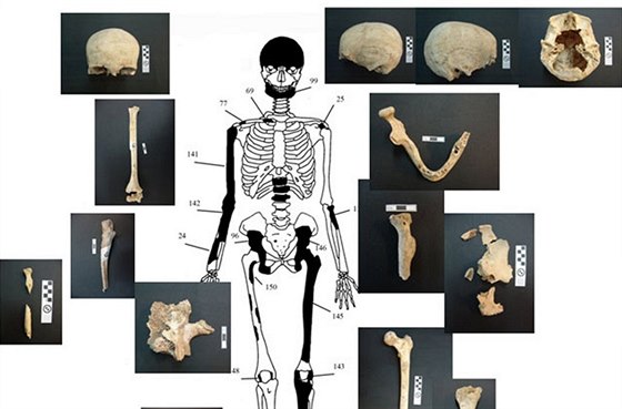 Schéma kostry ženy s ostatky, které se nalezly v hrobce Amfipolis na severu...