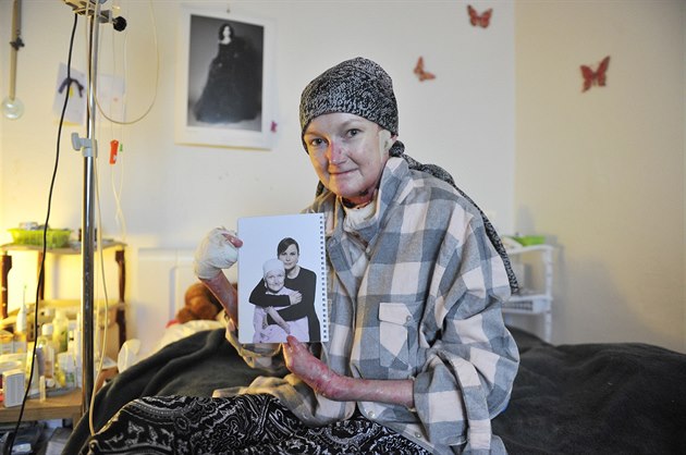 Olga Joklová mlad�í je odkázána na pé�i své maminky, která jí denn� m�ní...