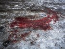 Krev jednoho z bojovník Doncké lidové republiky ped nemocnicí v centru...