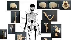 Schéma kostry eny s ostatky, které se nalezly v hrobce Amfipolis na severu...