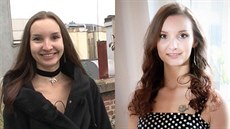 Iva p�ed a po prom�n�. P�ibrala kilo a cítí se mnohem lépe.