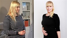 Jana p�ed prom�nou a po ní. Zhubla �est kilogram� a vypadá skv�le.
