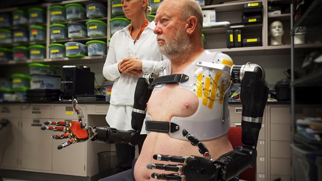 Prvn mu se dvma protzami celch pa dostal po 40 letech znovu monost dotkat se.