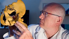 Traumatolog Jaroslav �rám s unikátní Omega dlahou.