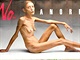 V Miln se objevily okujc billboardy s vyhublou modelkou Isabelle Caro,...