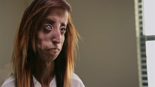 Píbh Lizzie Velasquezové