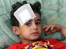 Chlapec zranní pi pátením sebevraedným útoku v Sanaa (21. bezna 2015).