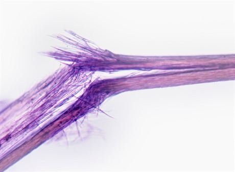 Takto vypad vlas s roztepenmi koneky pod mikroskopem. Mete vidt vrazn...