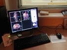 Klinika zobrazovacíh metod FN v Plzni pouívá nový diagnostický pístroj...