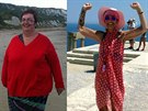 Z morbidn obézní eny se bhem dvou let diety stala anorektika.
