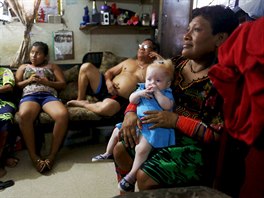 Eight-month-old Aisha Guerrero, who is part of the albino or "Children of the...