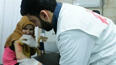 Popálené dít v nemocnici podporované Lékai bez hranic na severu Sýrie.