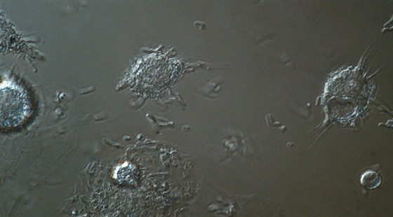 Souboj makrofágů proti bakteriím E.coli