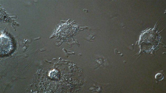 Souboj makrofág proti bakteriím E.coli