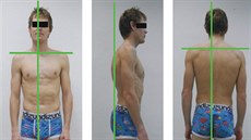 P�i sportu i práci získané svalové nerovnováhy se podepisují na na�em b�eckém...