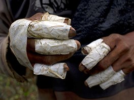 This June 20, 2015 photo shows the fingers of laborer Walter Perez wrapped in...